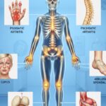 maladies rhumatismales